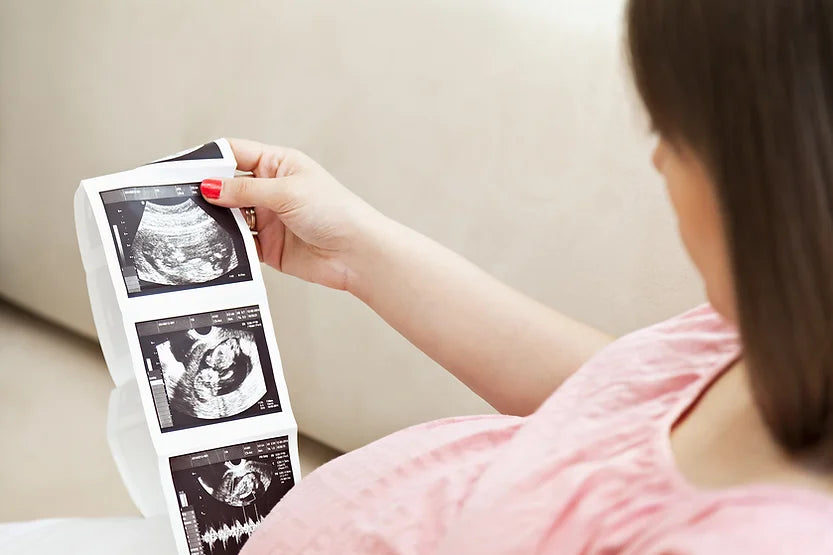 Ultrasounds : Types of Scans